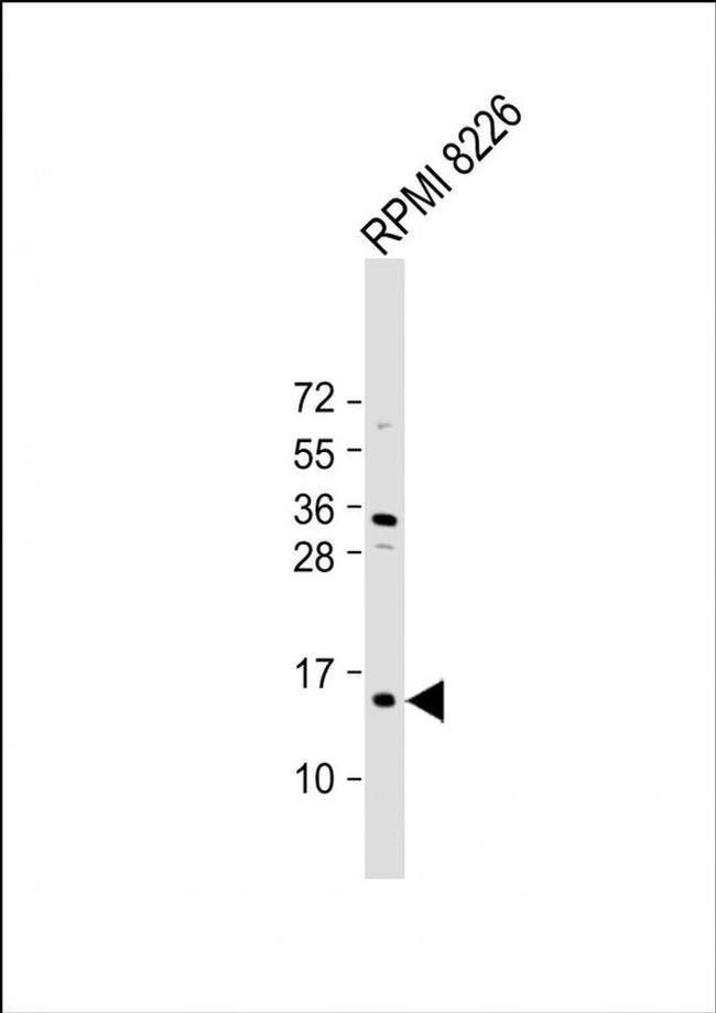ZNRD1 Antibody in Western Blot (WB)