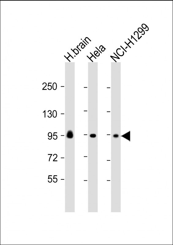 GALC Antibody in Western Blot (WB)