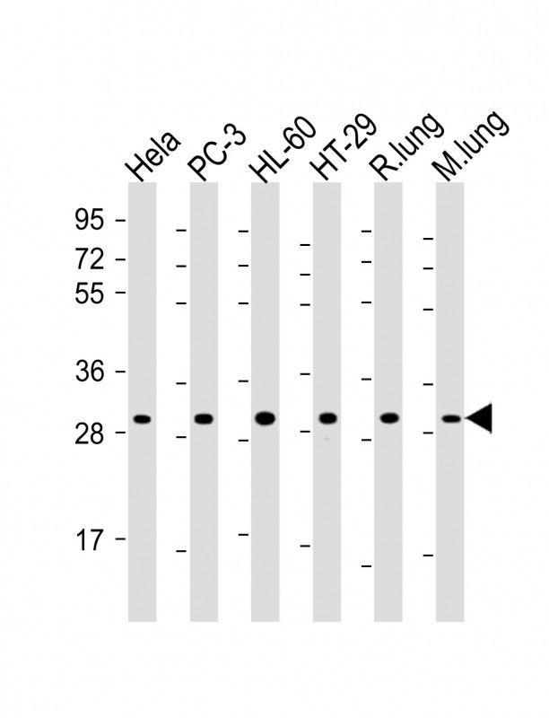 RPS4X Antibody in Western Blot (WB)