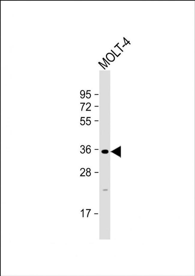 GLT6D1 Antibody in Western Blot (WB)