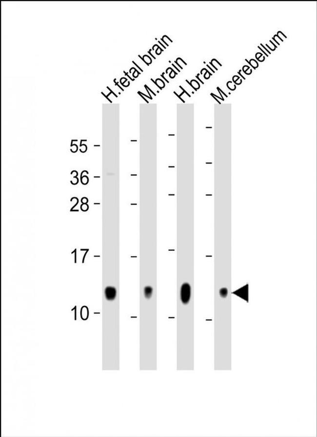 GNG3 Antibody in Western Blot (WB)