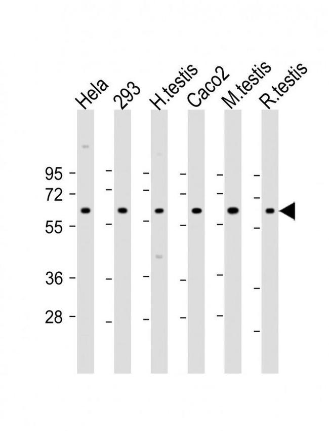 SLC2A8 Antibody in Western Blot (WB)
