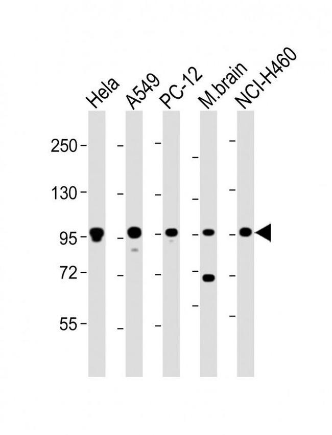 PCSK1 Antibody in Western Blot (WB)