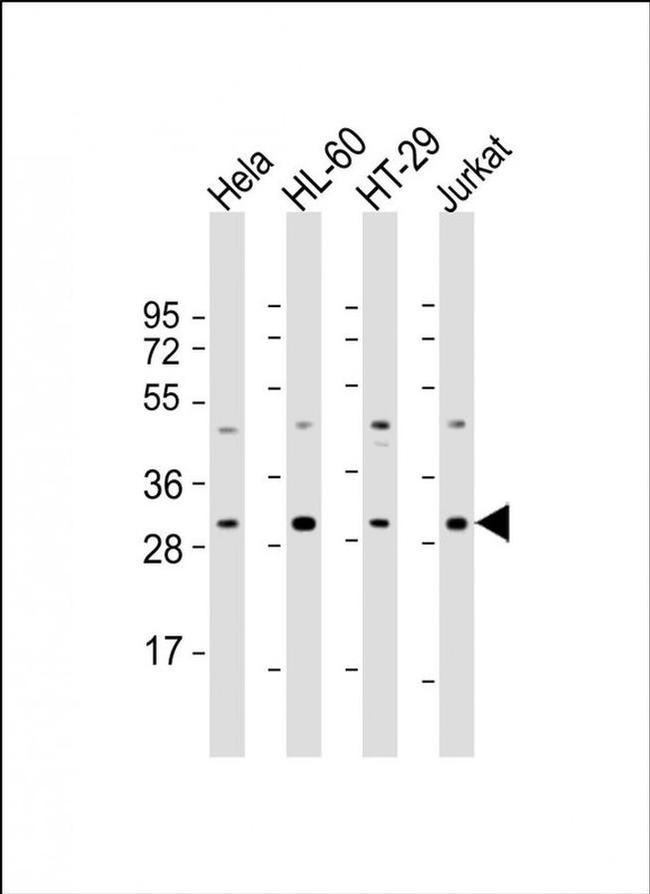 CSN7b Antibody in Western Blot (WB)
