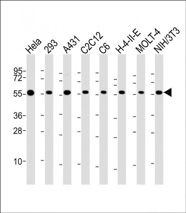 RAD21 Antibody in Western Blot (WB)
