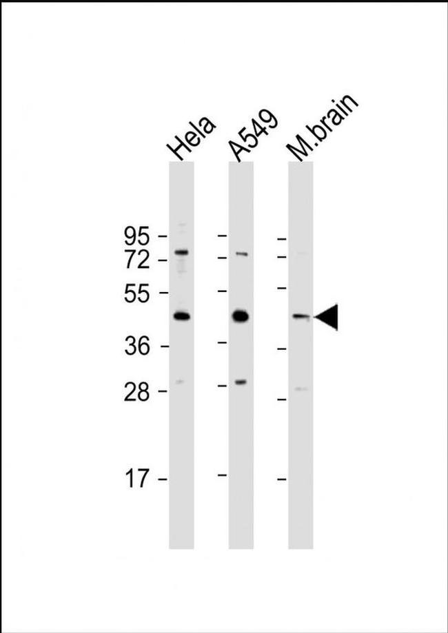 G6PC3 Antibody in Western Blot (WB)