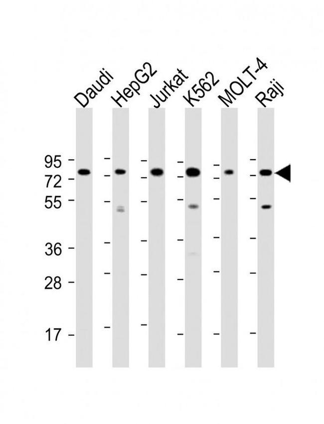 PABPC3 Antibody in Western Blot (WB)