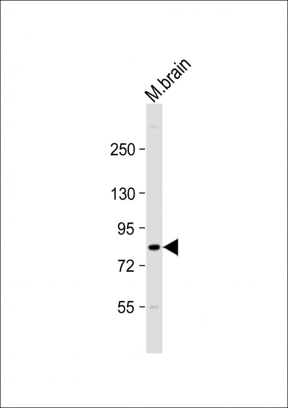 CIP2A Antibody in Western Blot (WB)