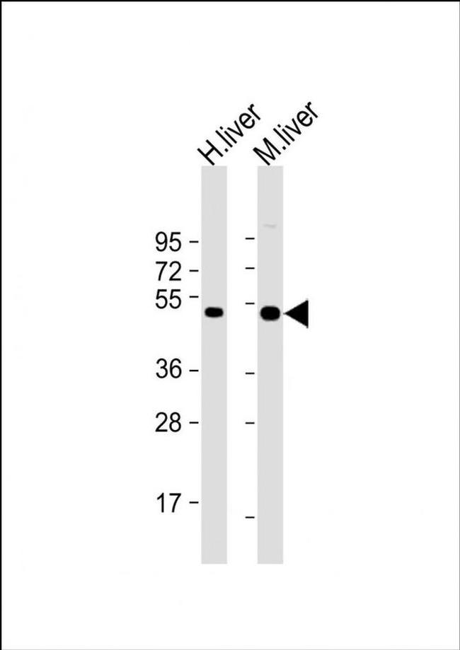 CTBS Antibody in Western Blot (WB)