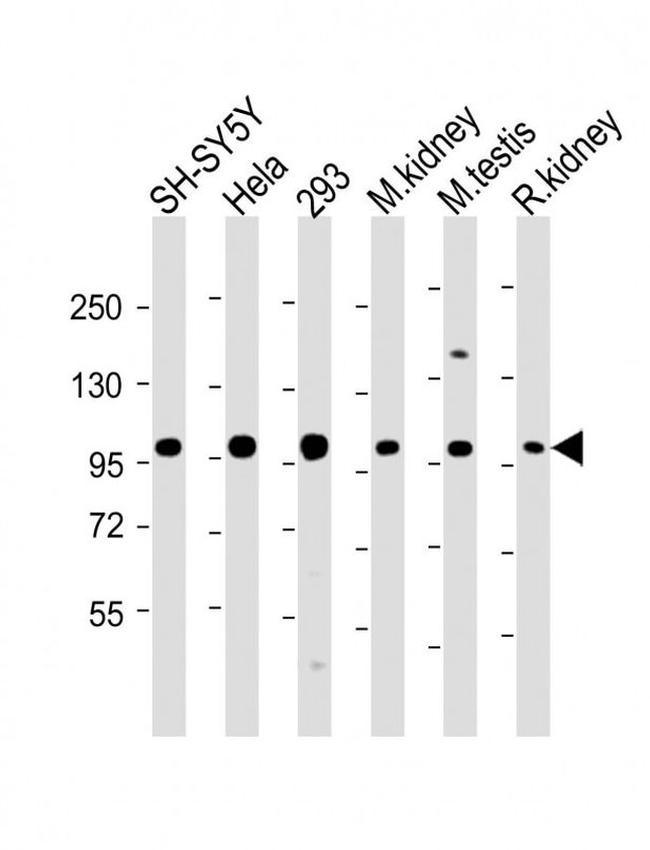 PGAP1 Antibody in Western Blot (WB)