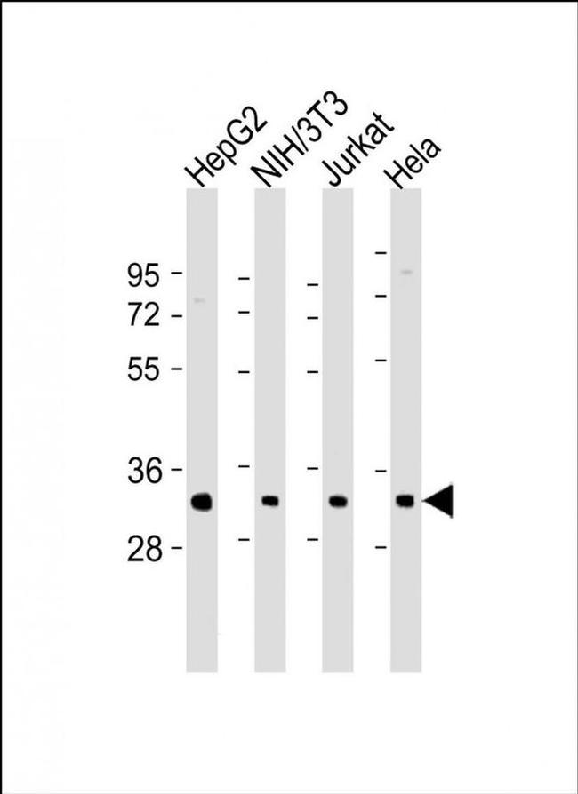 RPS2 Antibody in Western Blot (WB)