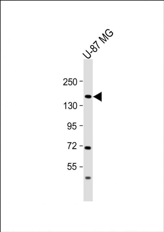 ADAMTS20 Antibody in Western Blot (WB)