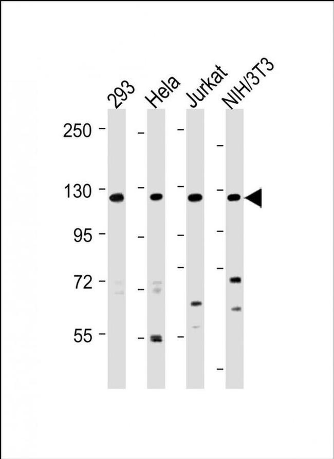 INTS3 Antibody in Western Blot (WB)