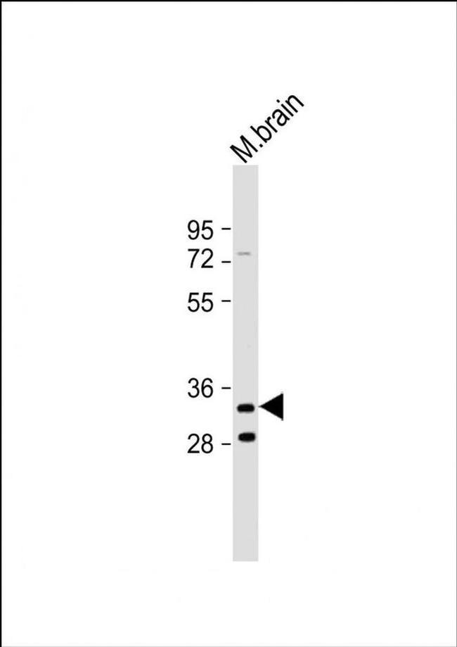 TMEM106B Antibody in Western Blot (WB)