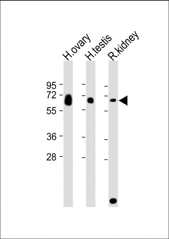 GGT3P Antibody in Western Blot (WB)