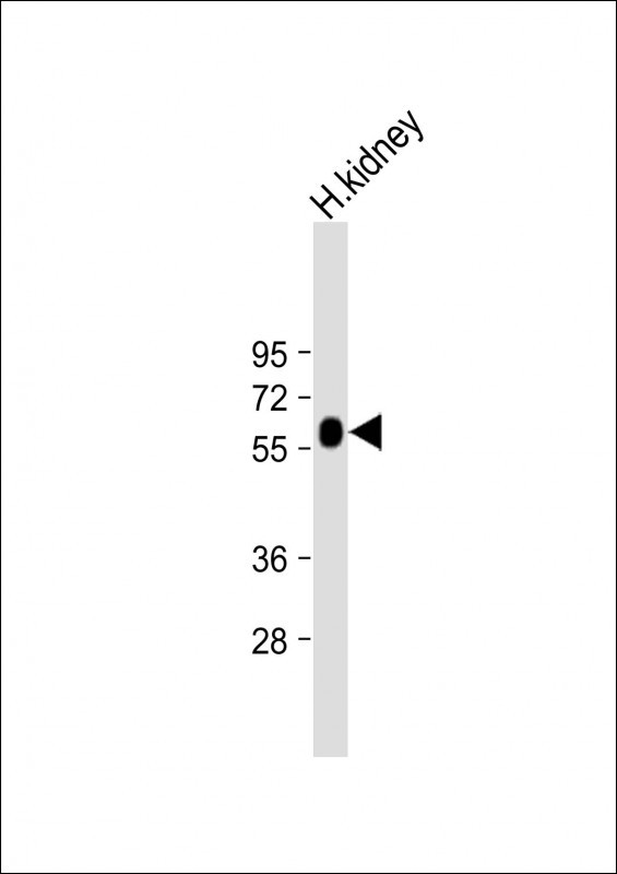 GGT3P Antibody in Western Blot (WB)