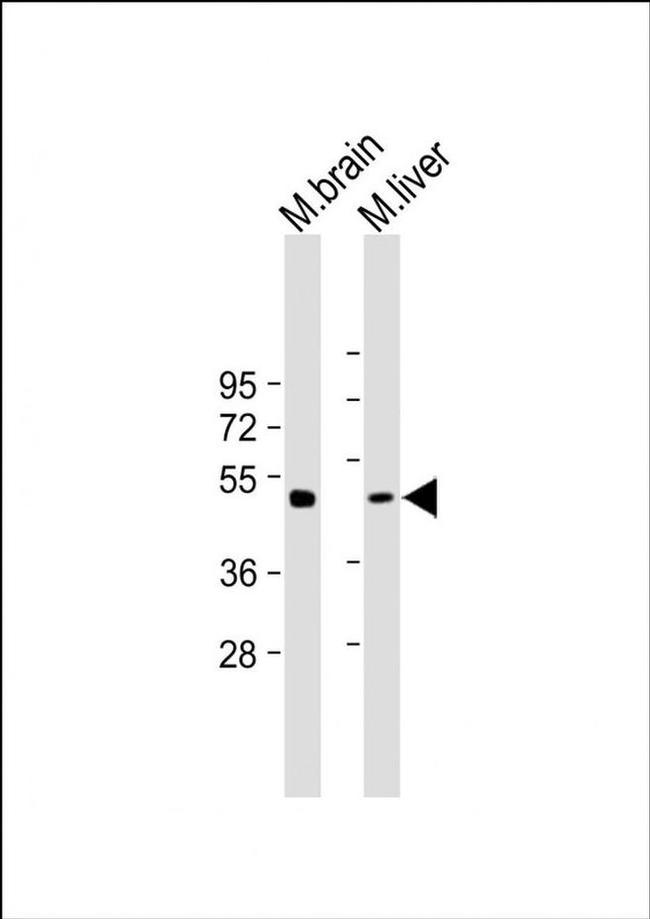 TUBG2 Antibody in Western Blot (WB)
