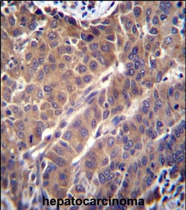 ARL2 Antibody in Immunohistochemistry (IHC)