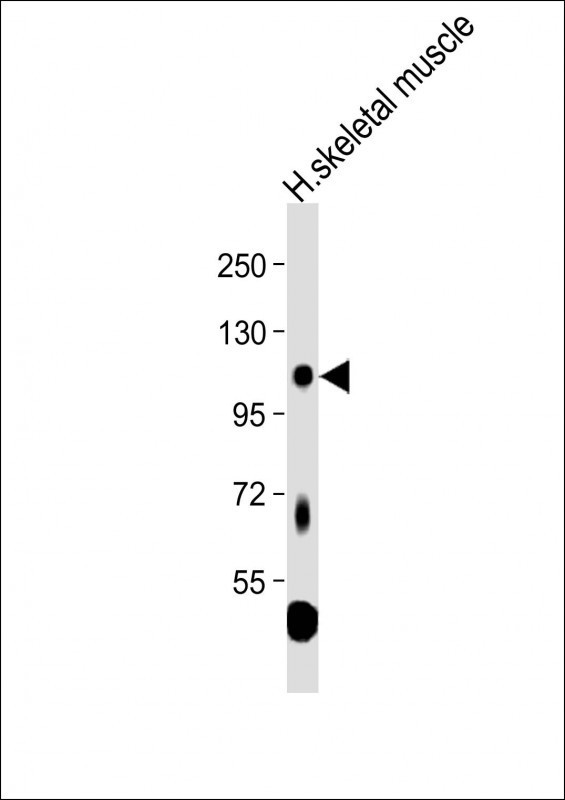 LGR5 Antibody in Western Blot (WB)