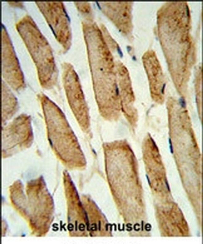 POLG2 Antibody in Immunohistochemistry (IHC)