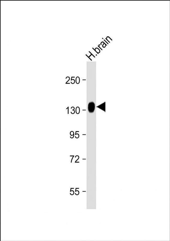 ENPP2 Antibody in Western Blot (WB)
