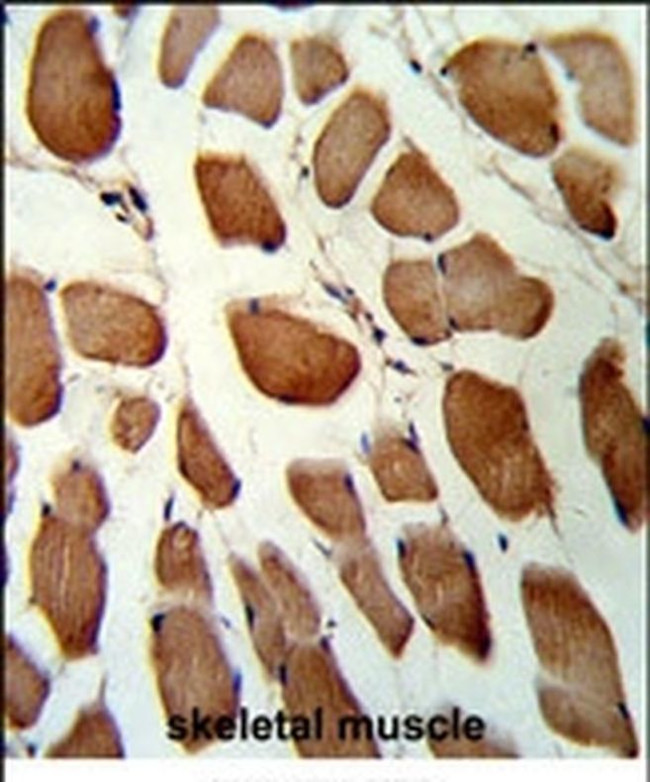 GST Omega 1 140A Antibody in Immunohistochemistry (IHC)