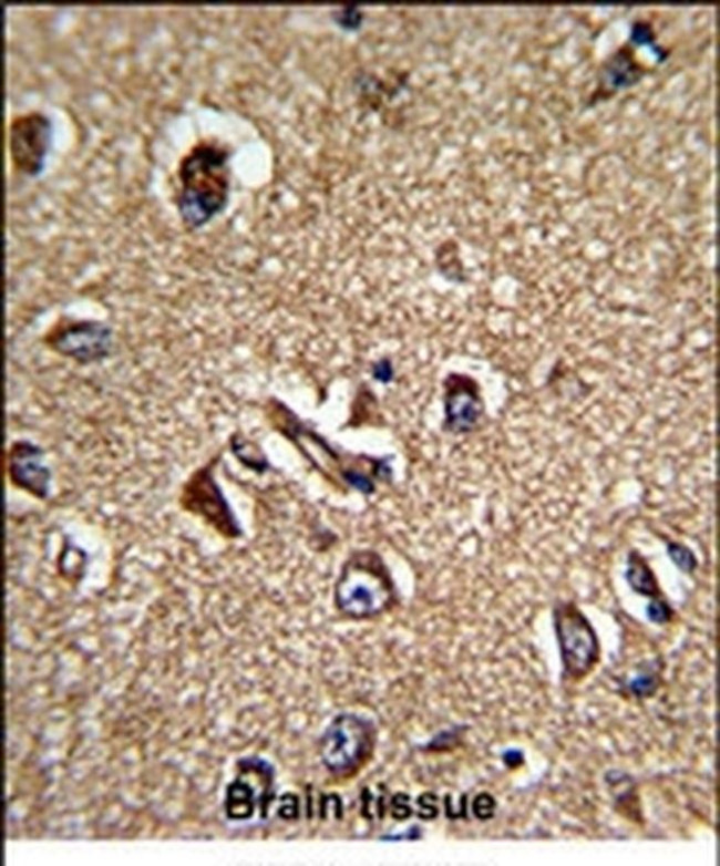 STRAP Antibody in Immunohistochemistry (IHC)