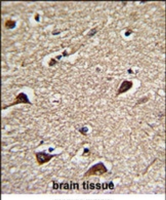 PGLS Antibody in Immunohistochemistry (IHC)