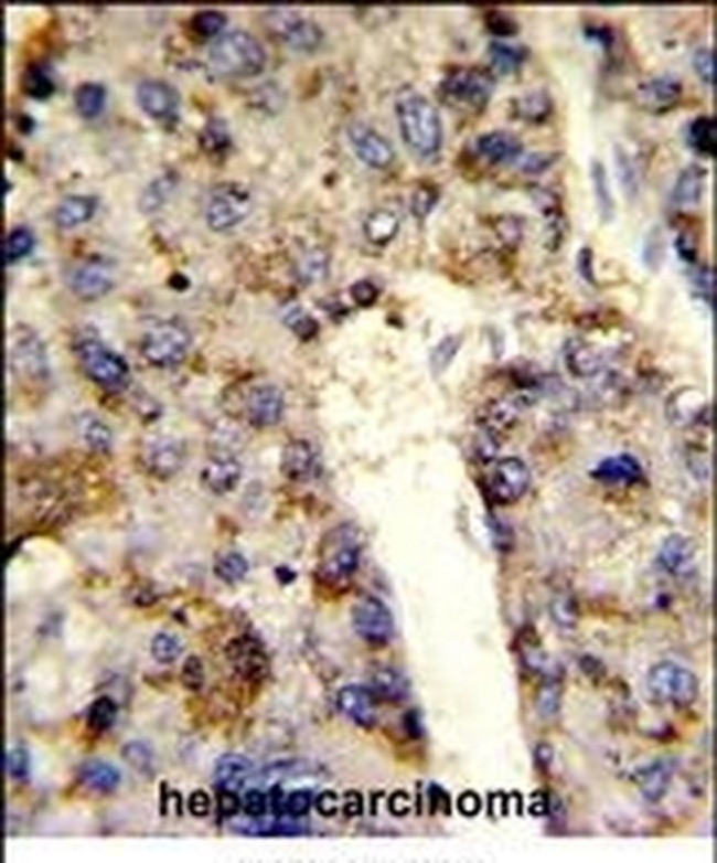 hnRNP L Antibody in Immunohistochemistry (IHC)