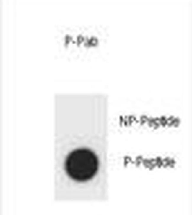 Phospho-AMOT (Tyr599) Antibody in Dot Blot (DB)