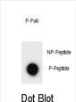 Phospho-ULK2 (Ser323) Antibody in Dot Blot (DB)