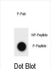 Phospho-Cyclin B3 (Thr257) Antibody in Dot Blot (DB)