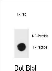 Phospho-TSC1 (Tyr297) Antibody in Dot Blot (DB)