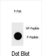 Phospho-Cyclin B3 (Ser1063) Antibody in Dot Blot (DB)