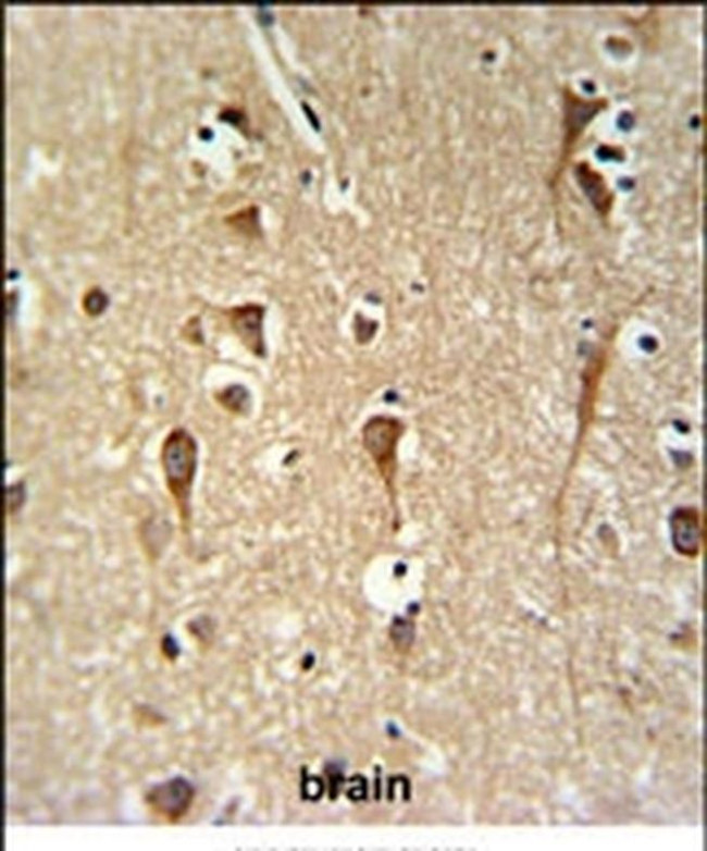 ZCCHC24 Antibody in Immunohistochemistry (IHC)