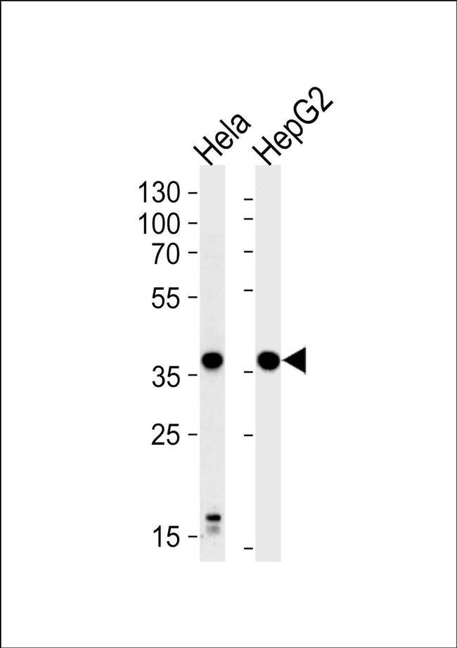 P2Y13 Antibody in Western Blot (WB)