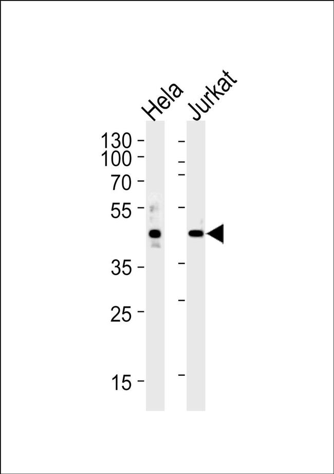 AVPR2 Antibody in Western Blot (WB)