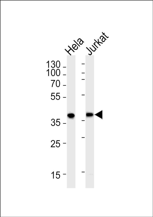 Protease-Activated Receptor-4 Antibody in Western Blot (WB)