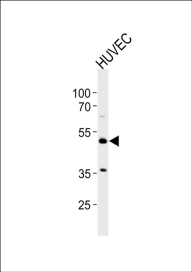 PTGIR Antibody in Western Blot (WB)