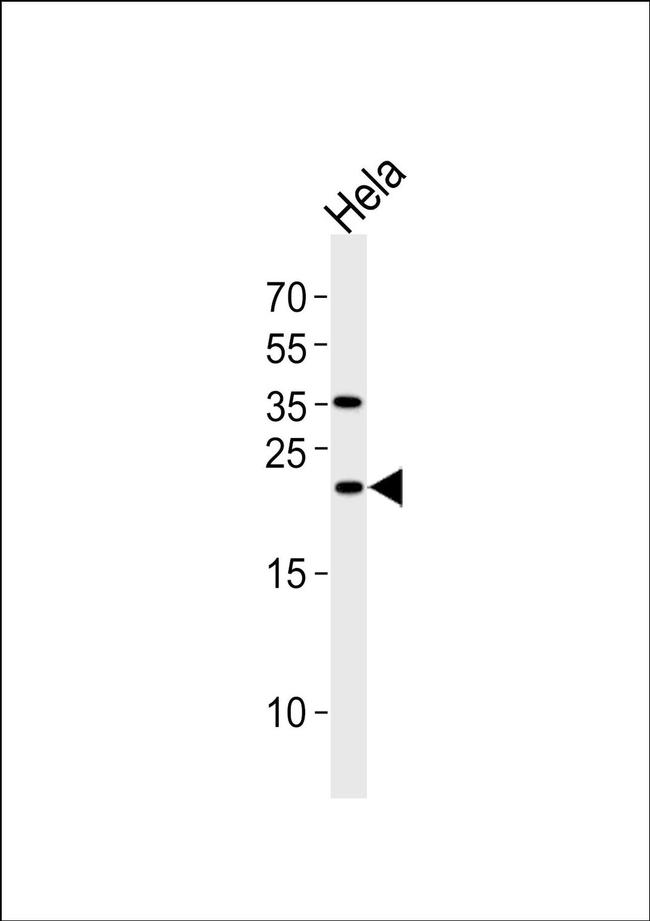 UBE2T Antibody in Western Blot (WB)