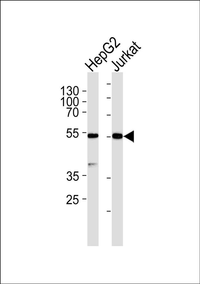 Protease-Activated Receptor-4 Antibody in Western Blot (WB)