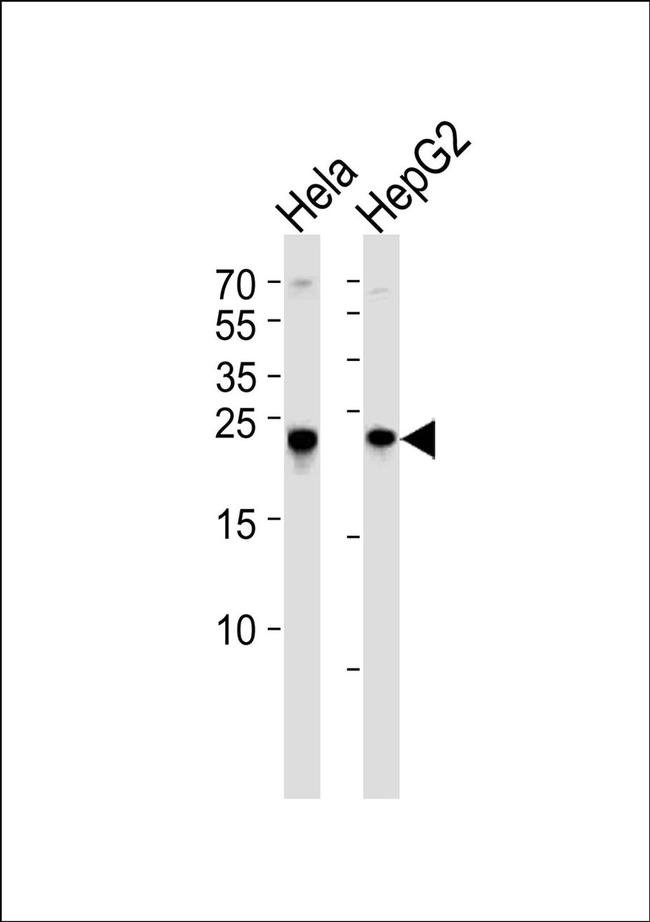 MRRF Antibody in Western Blot (WB)