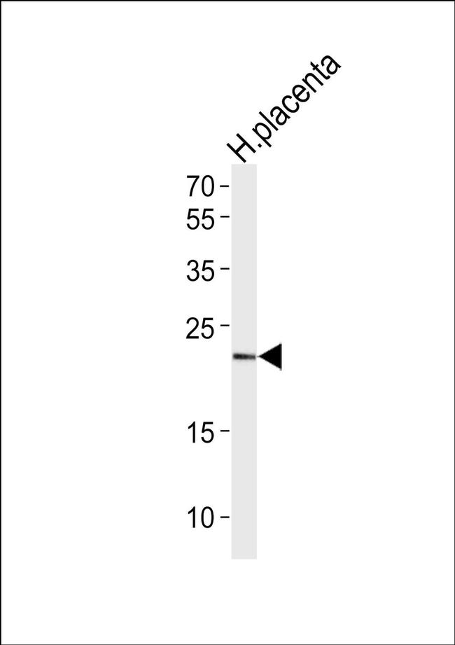 HES2 Antibody in Western Blot (WB)
