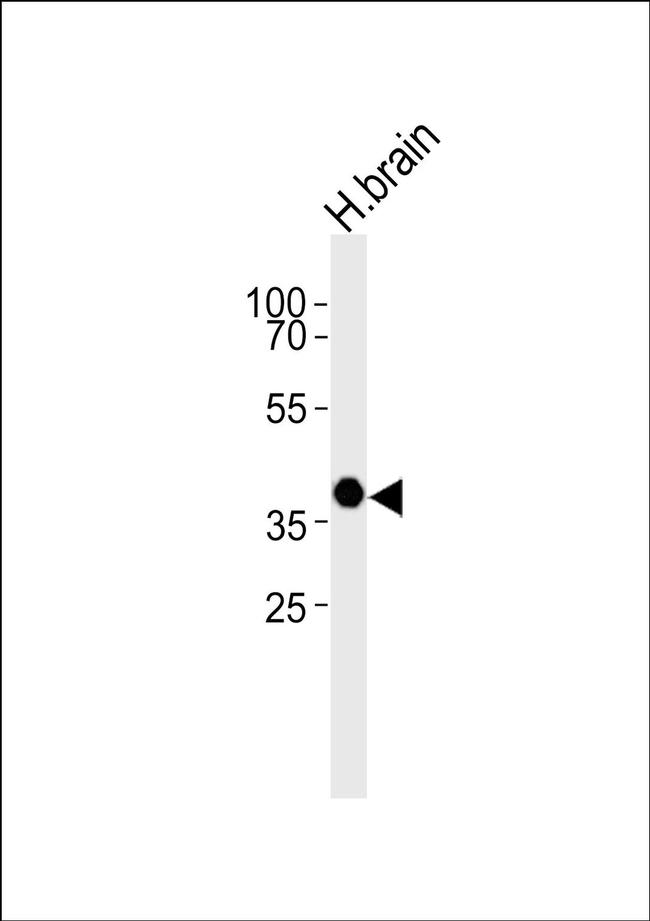 Opsin 5 Antibody in Western Blot (WB)