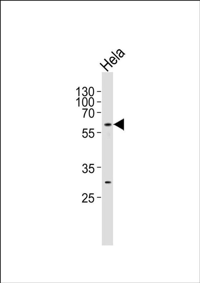 CPNE8 Antibody in Western Blot (WB)