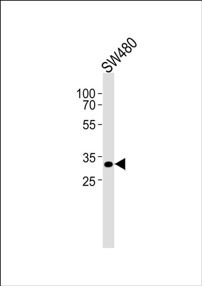 CEP76 Antibody in Western Blot (WB)
