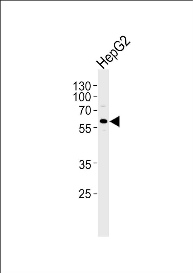 FIBB Antibody in Western Blot (WB)