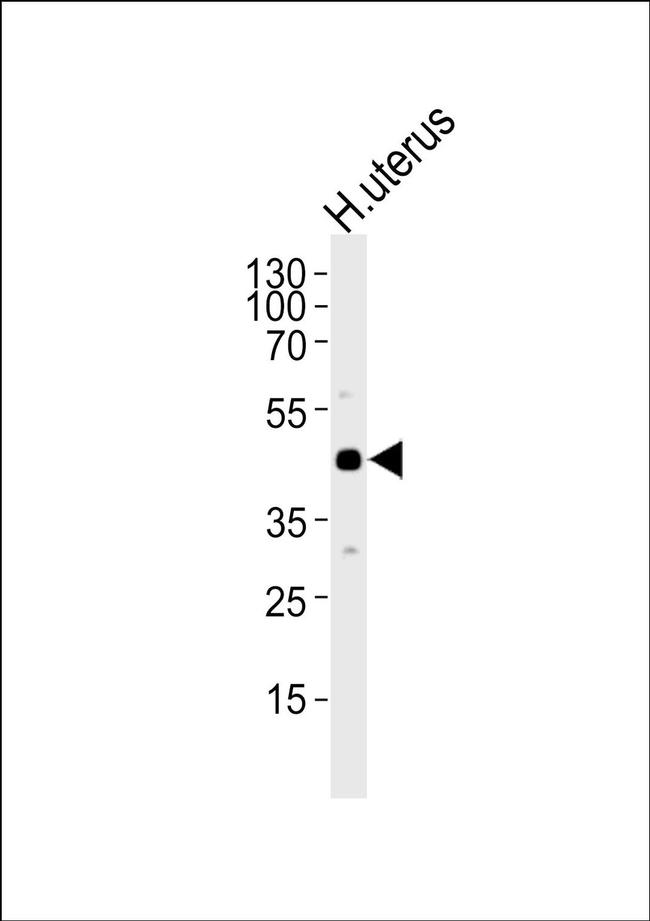TIM-1 Antibody in Western Blot (WB)