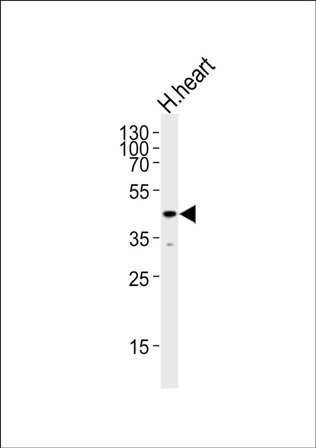 KLF2 Antibody in Western Blot (WB)
