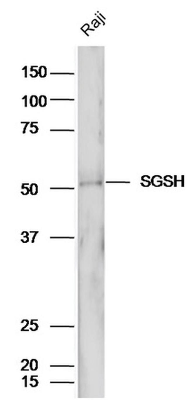 SGSH Antibody in Western Blot (WB)